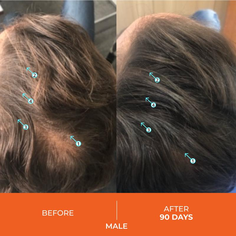 Cobody Hair Density Shampoo